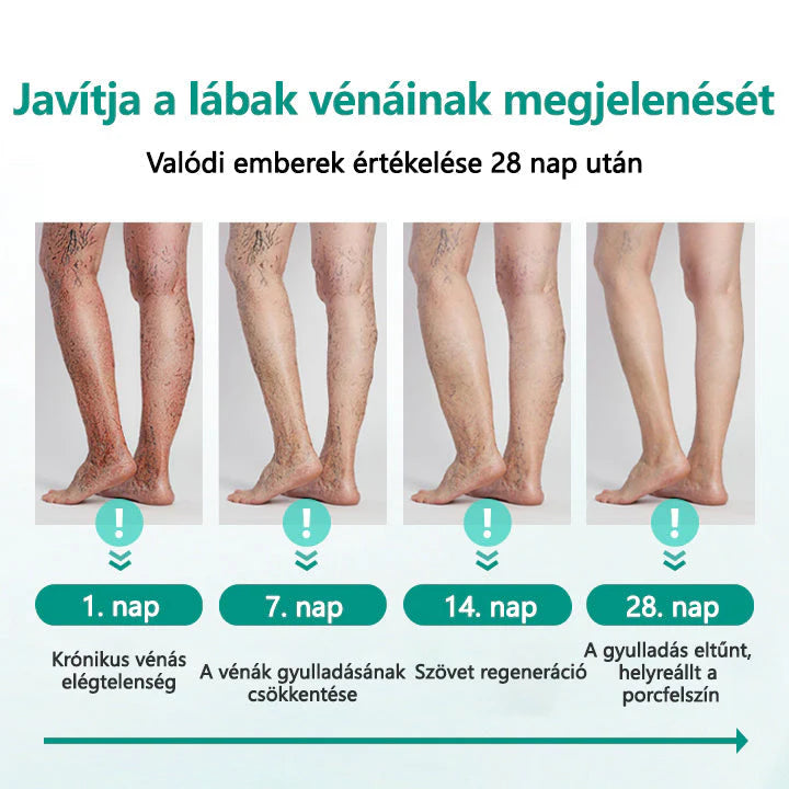 O adesivo para varizes Cvreoz® LegRenew melhora a saúde das veias e elimina as varizes. 🌿Sem agulhas, sem cirurgia, apenas resultados seguros, suaves e eficazes.