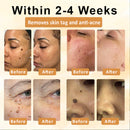 CastorBee Máscara para Marcas e Manchas