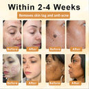 CastorBee Máscara para Marcas e Manchas