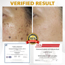 CastorBee Máscara para Marcas e Manchas