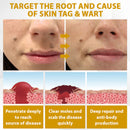 CastorBee Máscara para Marcas e Manchas