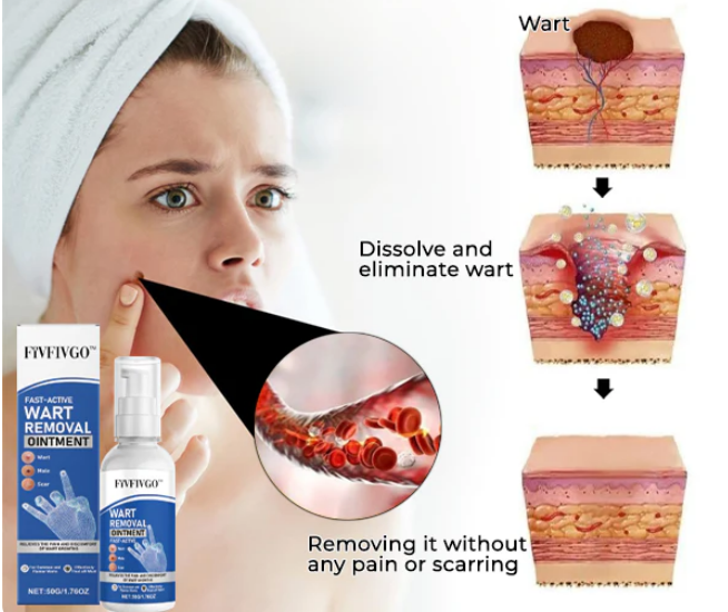 Spray Remove-Wart