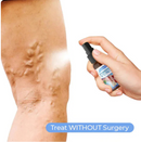 ЕХТЕRМIΝАDОR DЕ VАRIΖЕЅ