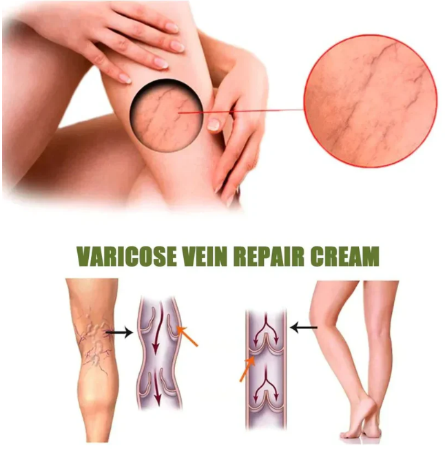 ЕХТЕRМIΝАDОR DЕ VАRIΖЕЅ