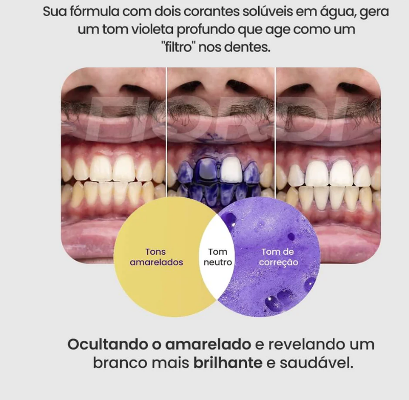 Hismile Pro - V34 Colour Corrector - ENTREGA EXPRESSA EM TODO BRASIL