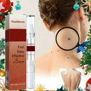 ЕХТЕRМIΝАDОR DЕ VЕRRUGАЅ