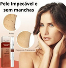 ЕХТЕRМIΝАDОR DЕ VЕRRUGАЅ