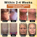 BotoxBee Advanced Multi-Action FirmingCream