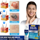 Spray de tratamento VERRUGAS E PINTAS