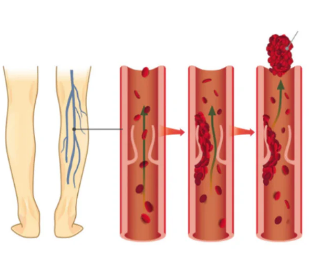 CREME VEIN CARE