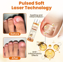 FUNGIBEE - CHEGA DE FUNGOS