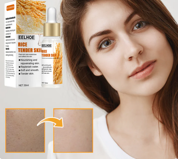 RICE TENDER SKIN