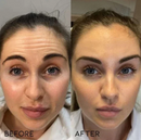 RETINOL - Antienvelhecimento Renovação da Pele