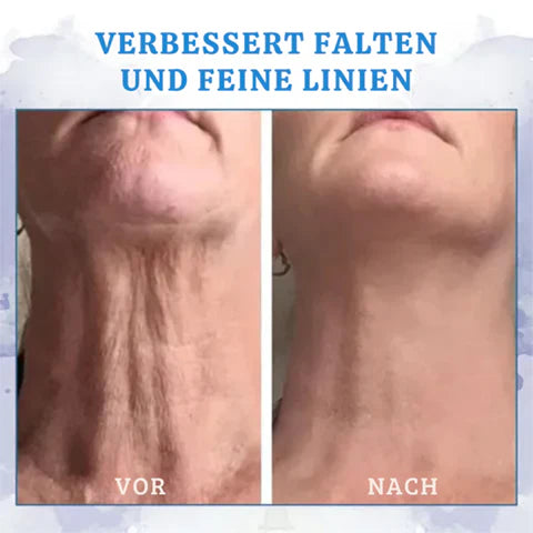 Ultra Firming