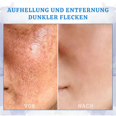 Ultra Firming