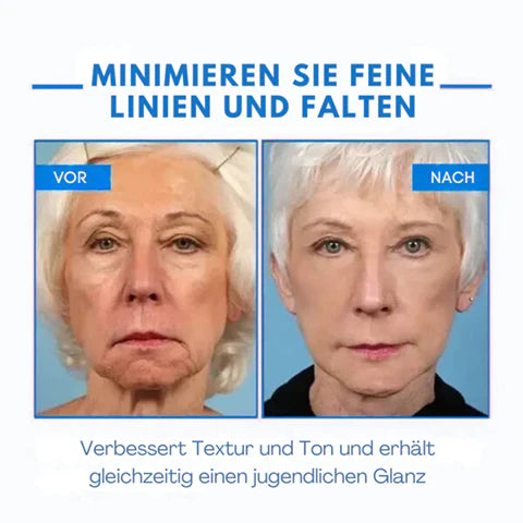 Ultra Firming