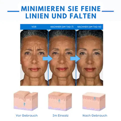 Ultra Firming