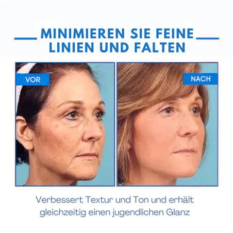 Ultra Firming