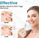 CANETA LASER BIKENDA